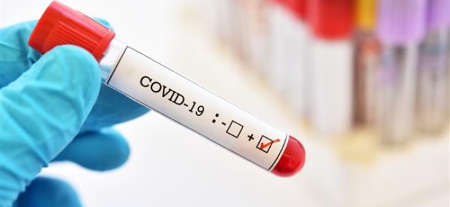 19 travelers among 635 new covid-19 cases in J&K, total 83064